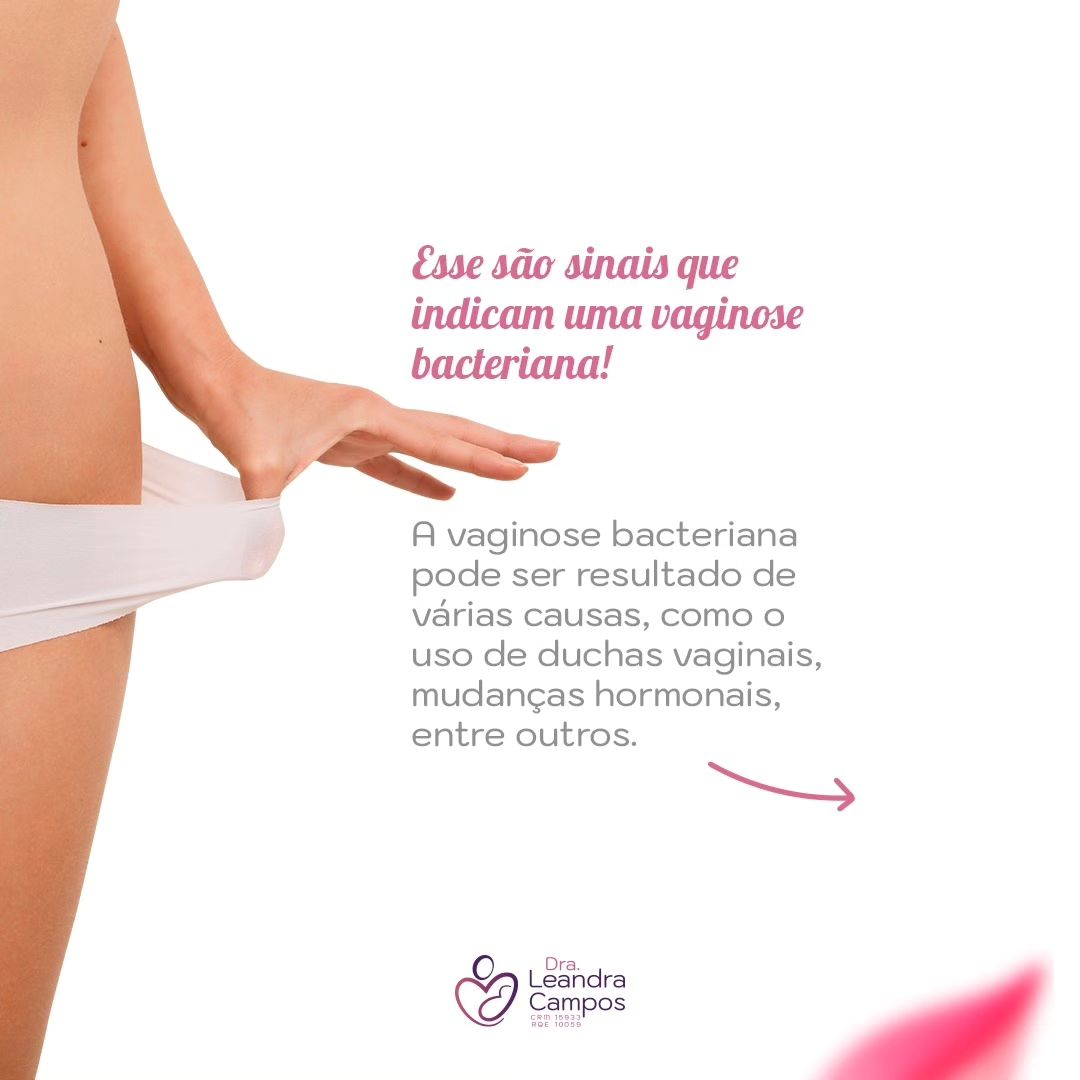 Vaginose Bacteriana: Guia Completo para Prevenção e Cuidado - Dra ...